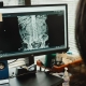 xray image of patient abdomen on computer monitor